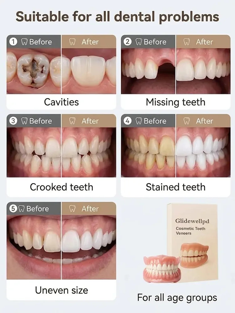 Ends Today: 60% OFF! ⏰Custom-Fit Instant Smile Dentures – Natural Looking Comfort Fit